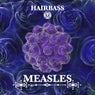 Measles