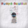 Bumps & Bruises