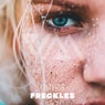 Freckles