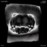 Slated (Remixes)