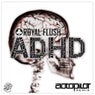 ADHD (Autopilot Remix)