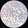 Plasma